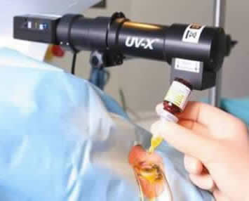 Cross-linking lasik Tunisie