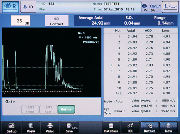  Echographie A/B et pachy lasik Tunisie