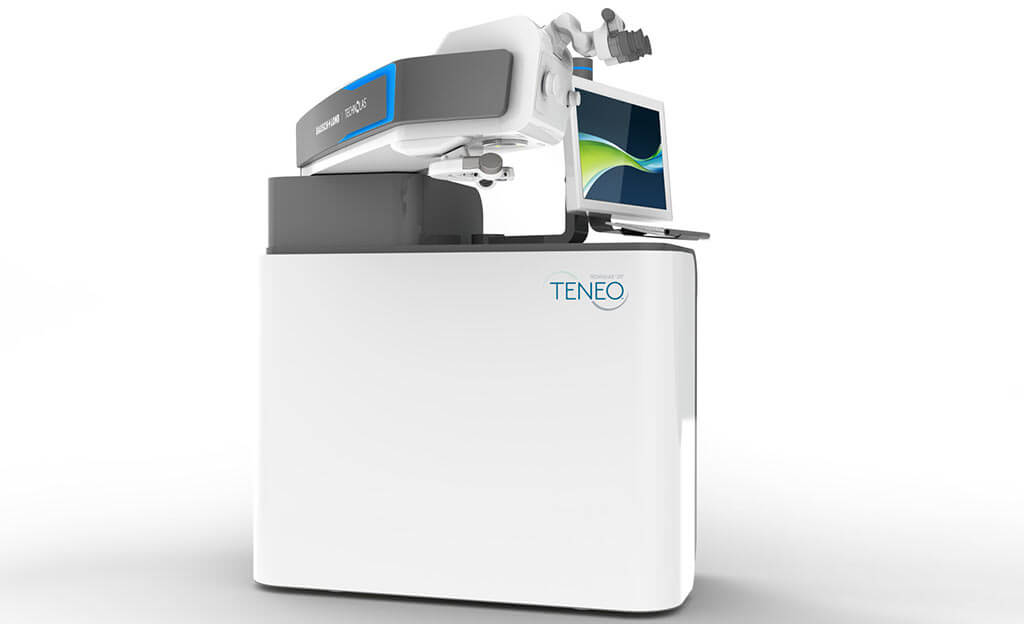 Teneo 317 bausch et lomb technolas lasik Tunisie