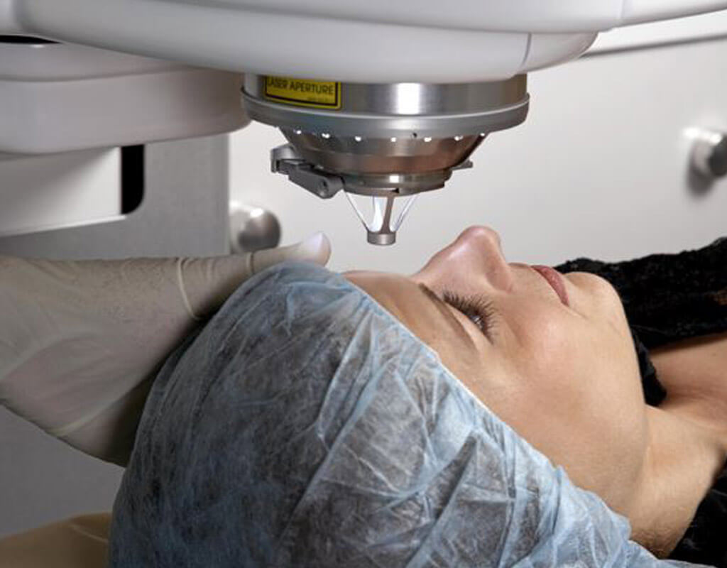 Мыть голову после операции катаракты. Лазерный кератомилез in situ ласик. Аппарат ласик для коррекции зрения.